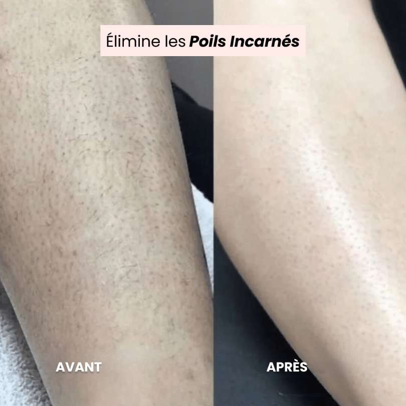 SilkTrim™ – Tondeuse 2-en-1 Ultra-Douce pour Zones Sensibles