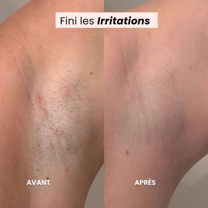 SilkTrim™ – Tondeuse 2-en-1 Ultra-Douce pour Zones Sensibles