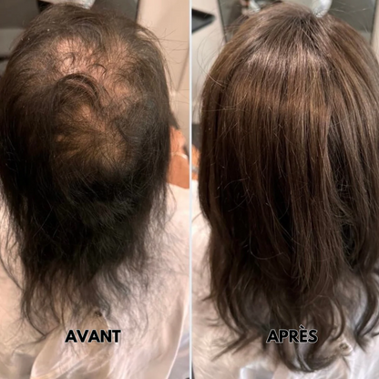 VibraHair™ – Peigne & Masseur Cuir Chevelu 3-en-1